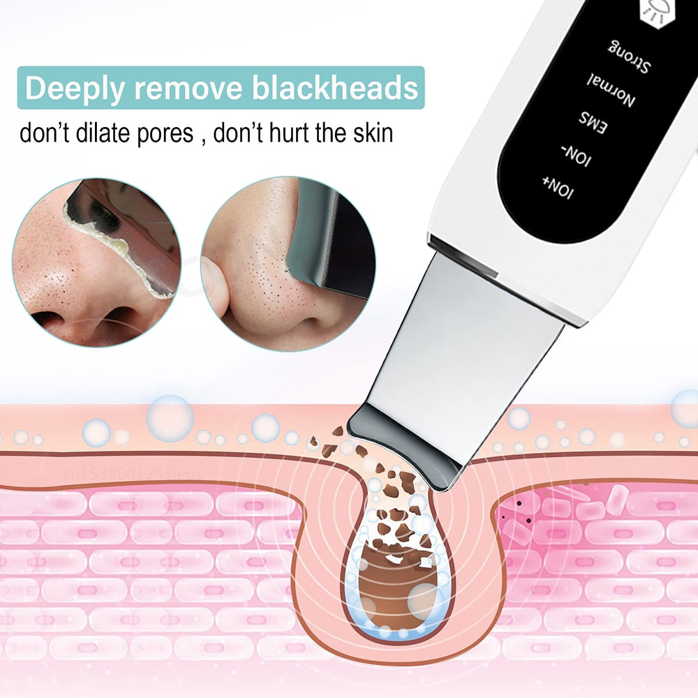 Ultrasonic Ion Face Cleaning and Blackhead Remover