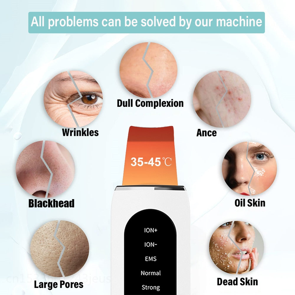 Ultrasonic Ion Face Cleaning and Blackhead Remover