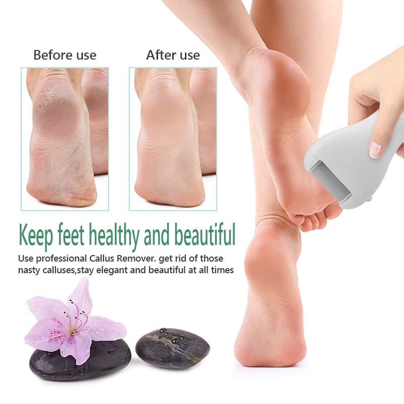 Electric Foot File for Pedicures