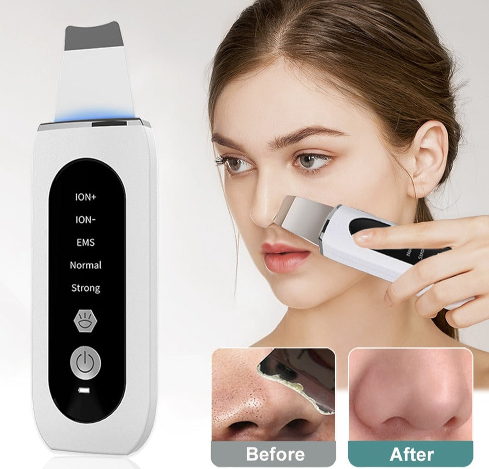 Ultrasonic Ion Face Cleaning and Blackhead Remover